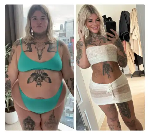 Before After-01