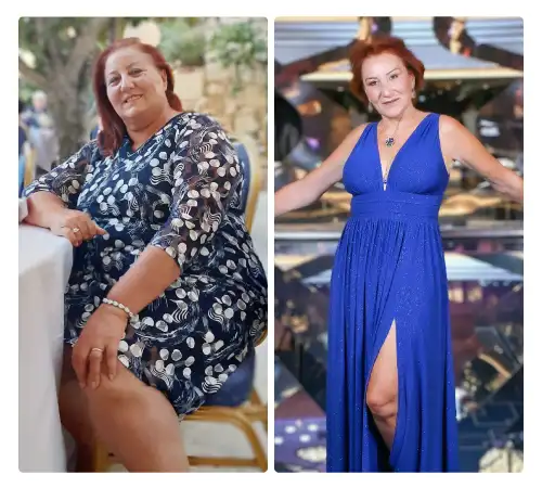 Before After-04