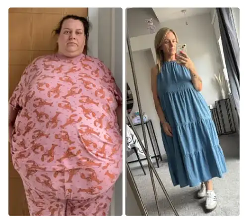 Before After-08