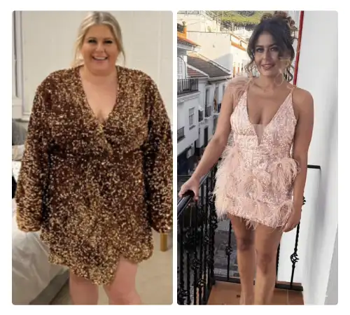 Before After-09