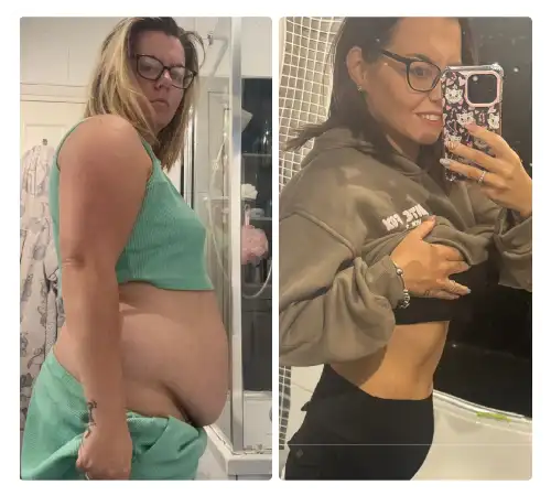 Before After-11