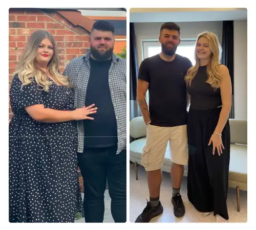 Before After-12