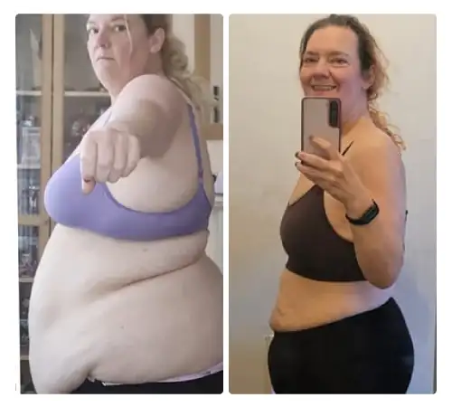 Before After-13