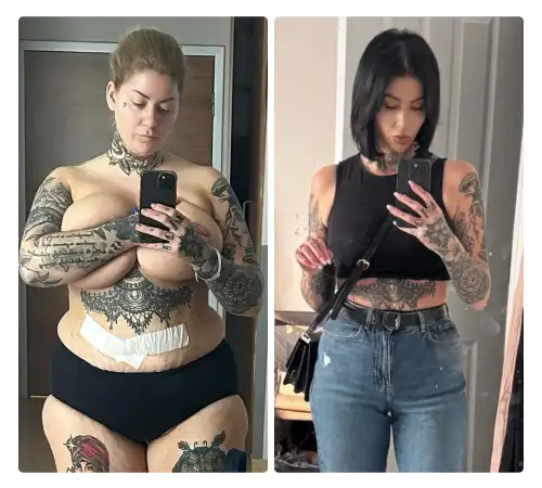 Before After-15