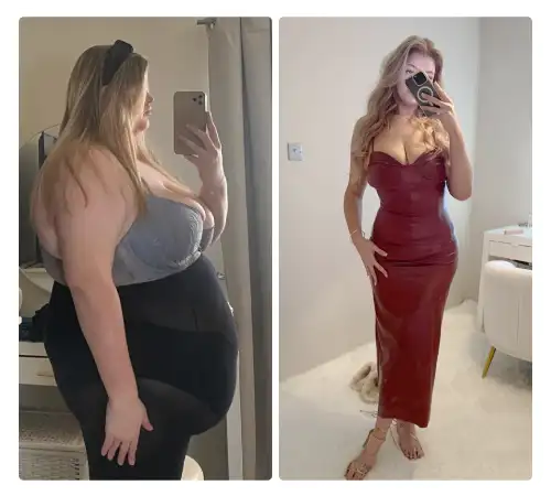 Before After-16