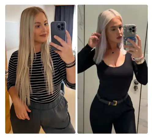 Before After-17