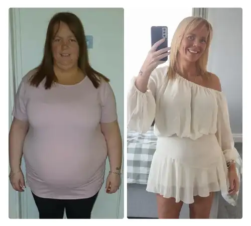 Before After-18