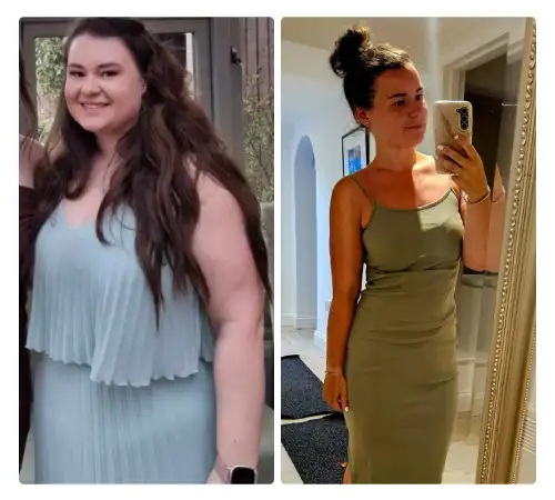 Before After-19