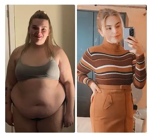 Before After-21