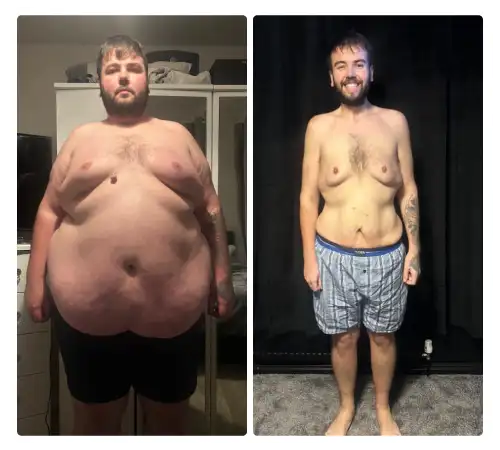 Before After-23