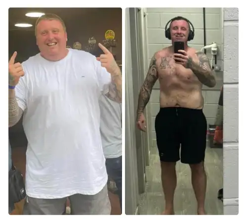 Before After-24