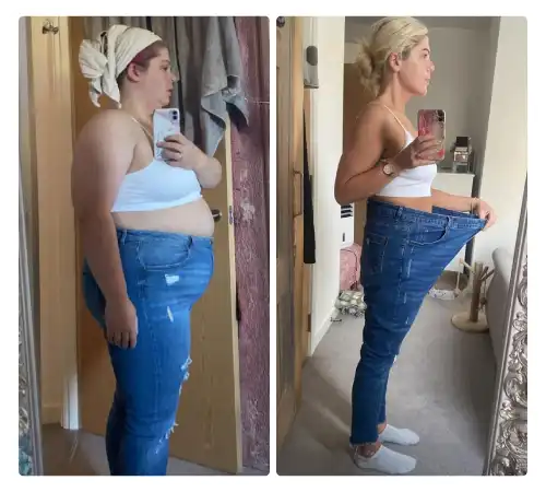 Before After Sleeve 2026-01
