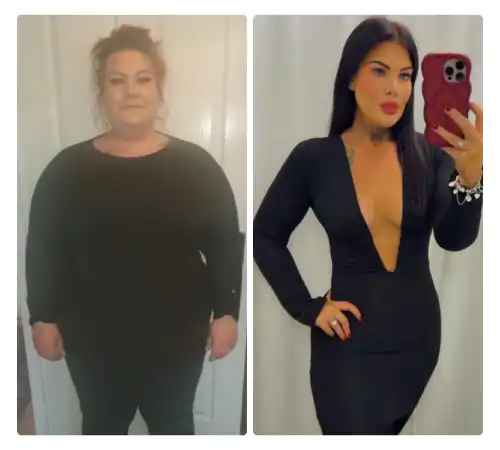 Before After Sleeve 2026-03