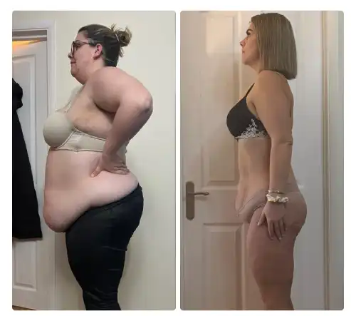 Before After Sleeve 2026-04