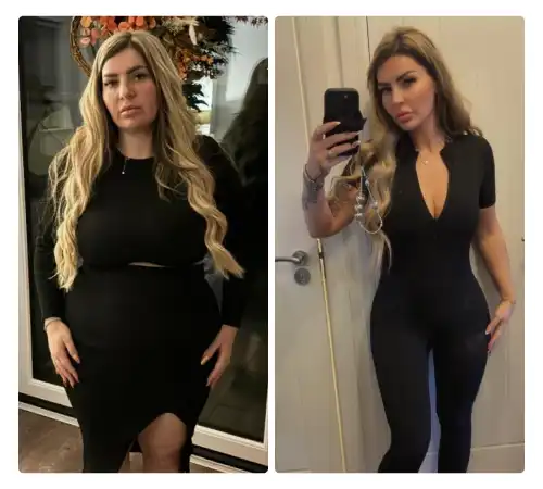 Before After Sleeve 2026-05