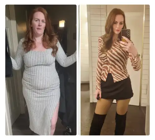 Before After Sleeve 2026-06