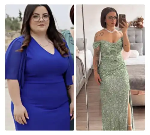Before After Sleeve 2026-07