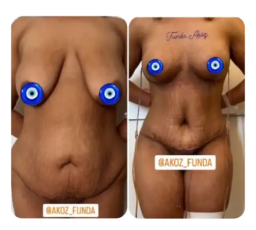 Breast-07