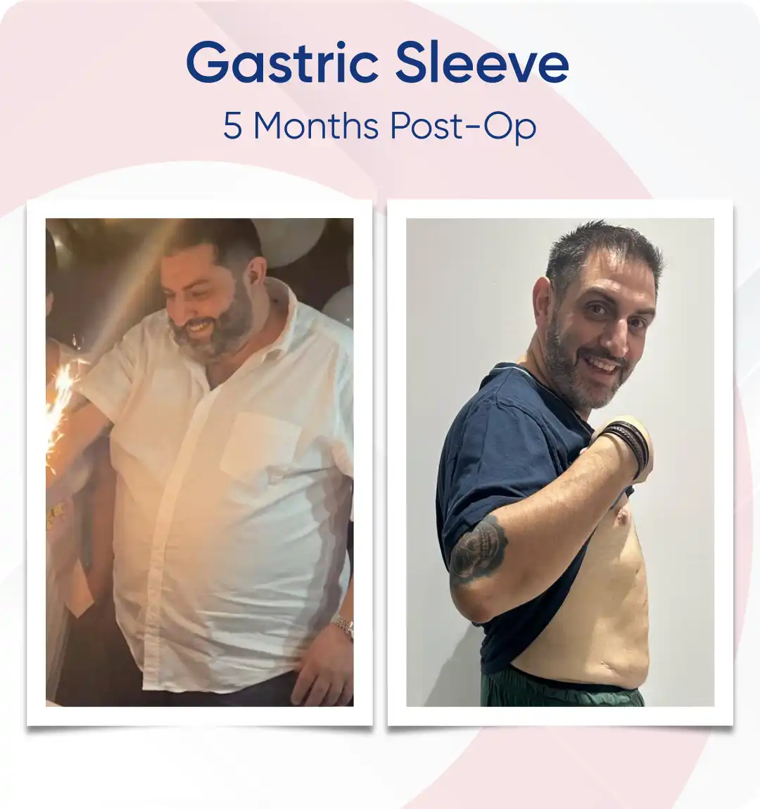 Before After Sleeve Landing-11
