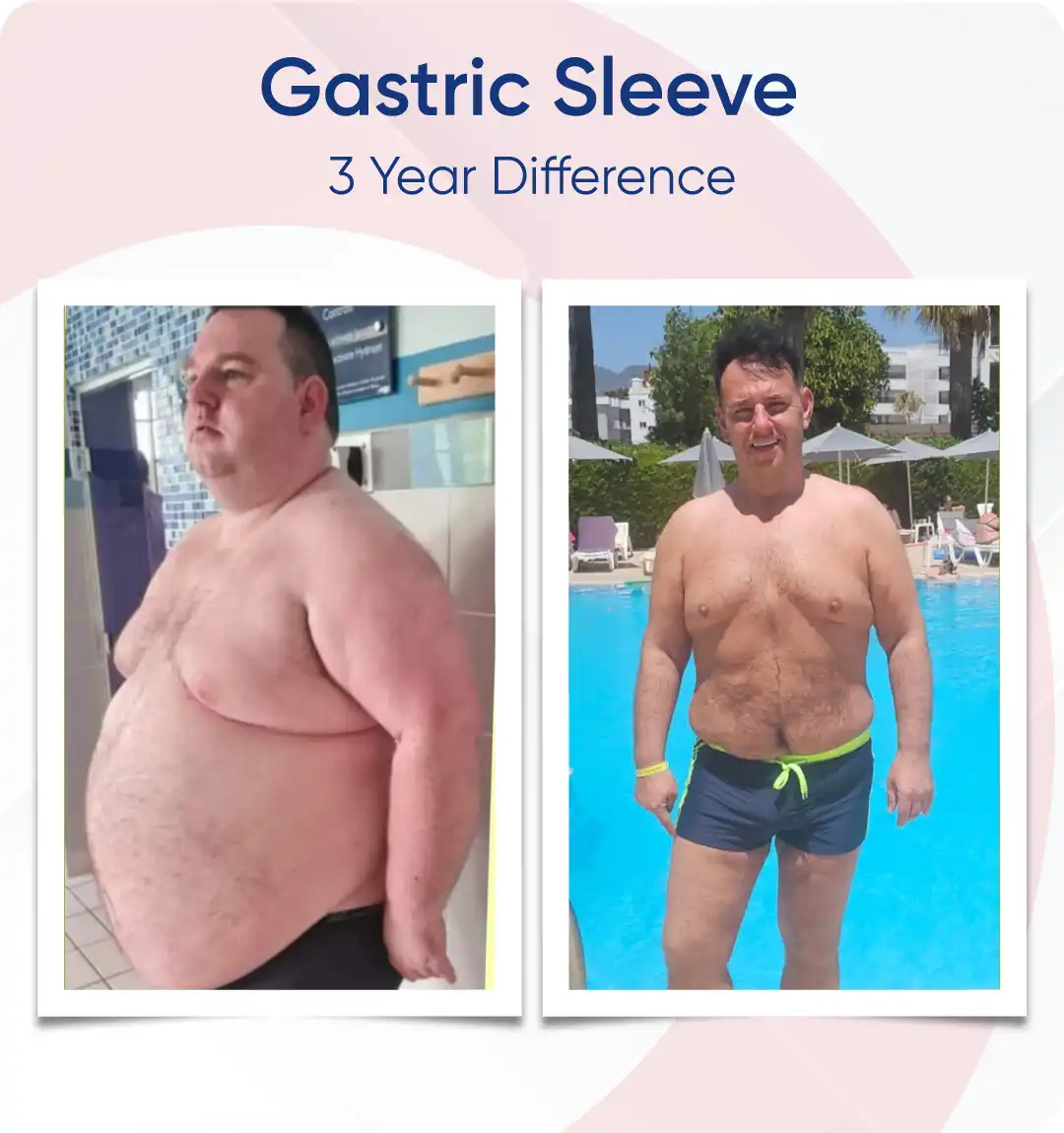 Before After Sleeve Landing-15